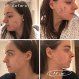 Instant Kalmer™ Ceramide Serum