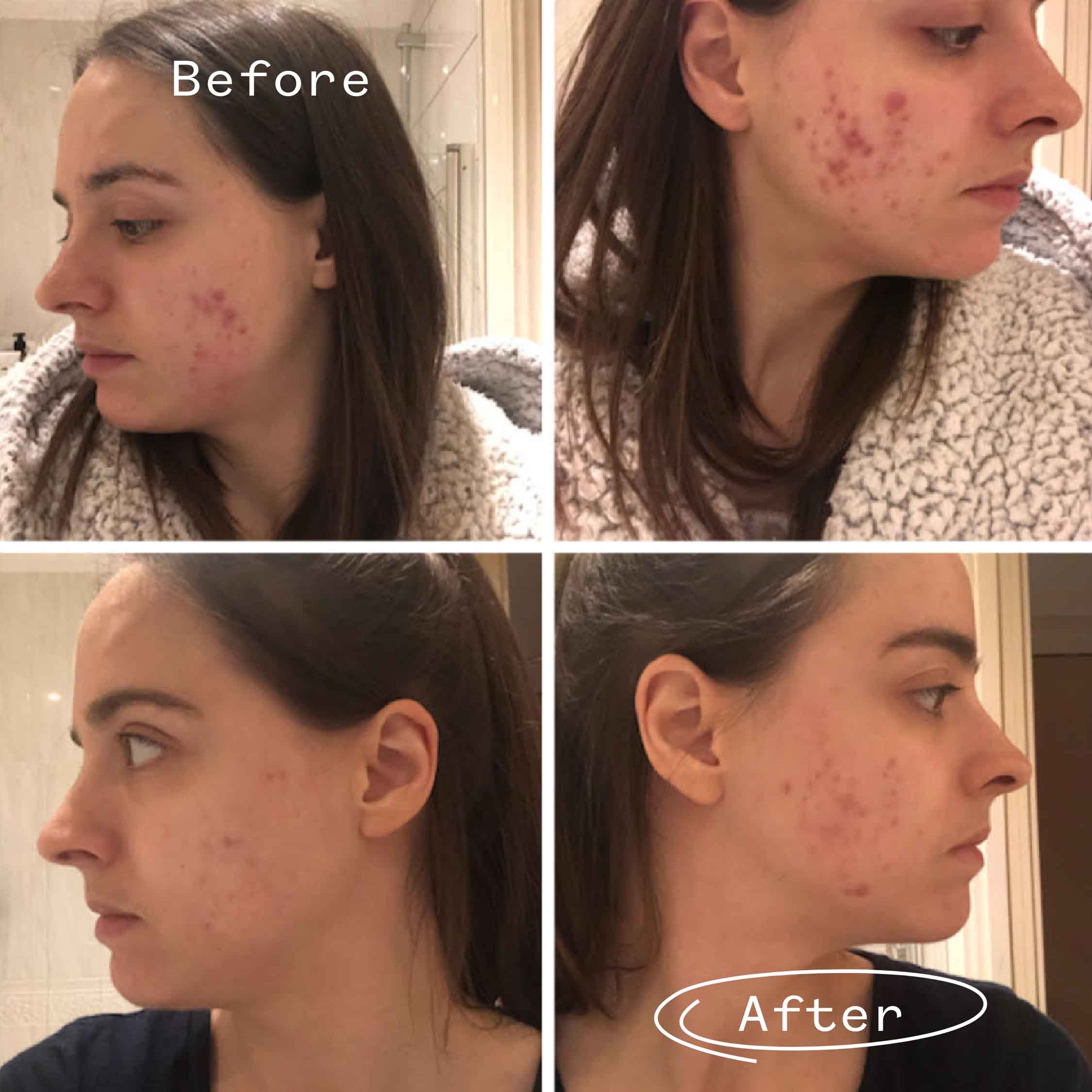 Pai Skincare UK