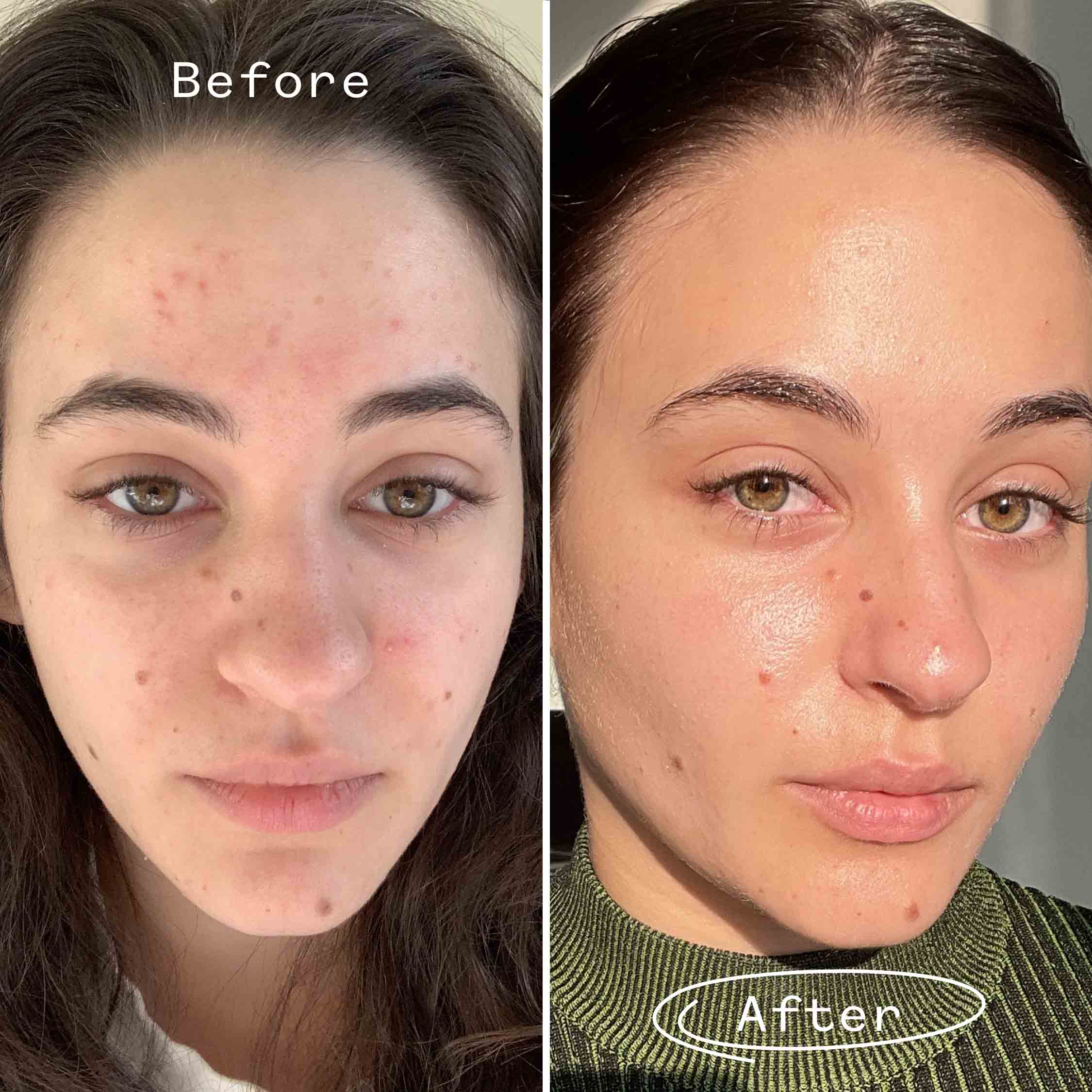 Pai Skincare UK